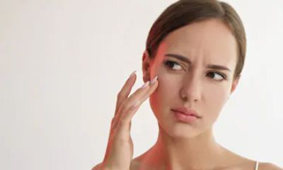 Stres Berkontribusi dalam Menyebabkan Wajah Breakouts